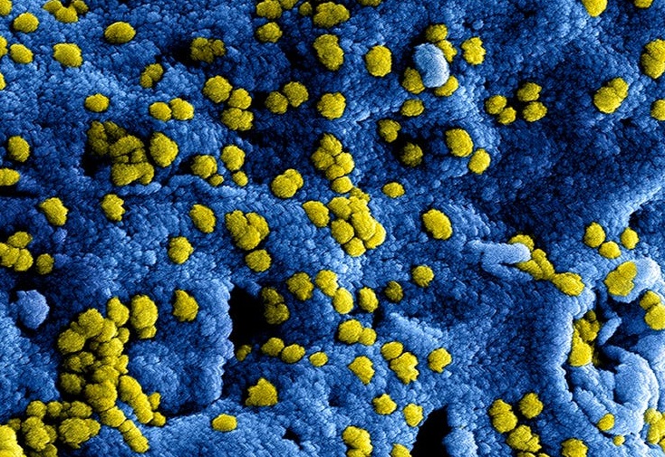 Al momento stai visualizzando Laboratori designati dalla Regione per testare l’Hantavirus nella nostra area