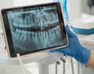 Scopri di più sull'articolo Agrigento – Sciacca, intrusione nei computer di uno studio dentistico: denunciata una 18enne